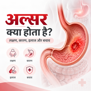 अल्सर क्या होता है? लक्षण, कारण, जाँच, इलाज और बचाव की पूरी जानकारी